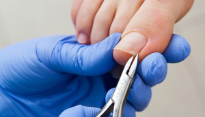 leczenie wrastajacych paznokci